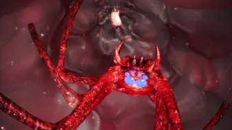 ATD – ULALAxSPIDER VERY HIGH