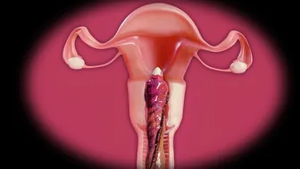 Tifa’s perfect pussy filled (X-ray version)