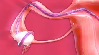3 holes, 5 tentacles – Tifa filled up by alien lifeform