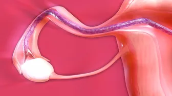 Tentacles breed Tifa – alien impregnation