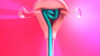 Tifa’s extreme inflation – tentacle breeding