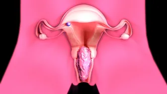 2B births a huge slug