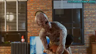 Valentine Breast Augmentation – Non-Infested version