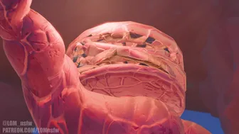 [LOM] EP.1 Varesa vs ???